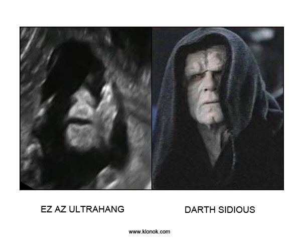 Ultrahang - Darth Sidious
 
