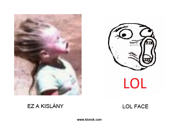 Kislány - LOL Face
 
